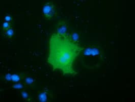 FAM84B Antibody (clone OTI10F2)
