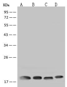RPS10 / Ribosomal Protein S10 Antibody