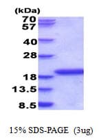 Human IL36RN / IL1F5 Protein (Recombinant His)