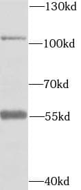 EPHA2 / EPH Receptor A2 Antibody
