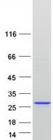 Human MED18 Protein (Recombinant Myc-DDK (Flag))