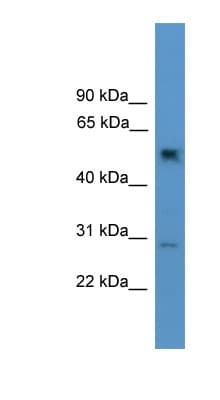 Polyclonal Rabbit anti-Mouse PPP2R2C Antibody (aa21-70, WB)