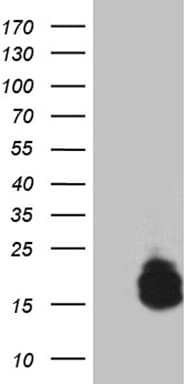 PTH / Parathyroid Hormone Antibody (aa32-115, clone OTI2D3, Carrier-free)