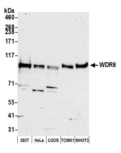 Polyclonal Rabbit anti-Human WDR6 Antibody (aa1071-1121, WB)