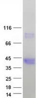 Human HAO2 Protein (Recombinant Myc-DDK (Flag))