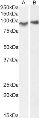 IHC-plus™ ACAP2 / Centaurin Beta 2 Antibody (aa766-778)