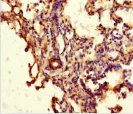 Polyclonal Rabbit anti-Human ABCG8 Antibody (IHC, IF, WB)
