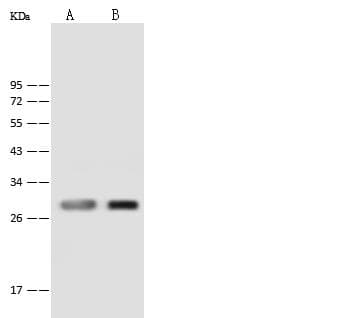 Polyclonal Rabbit anti-Human PNPO Antibody (IHC, WB)