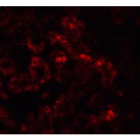 TNFRSF10B / Killer / DR5 Antibody