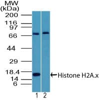 IHC-plus™ Polyclonal Rabbit anti-Human Histone H2A.X Antibody (aa50-100, IHC, WB)