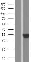 FRAT1 Protein (Over-Expression Lysate Myc-DDK (Flag))