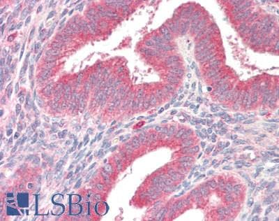 IHC-plus™ ASPN / Asporin Antibody