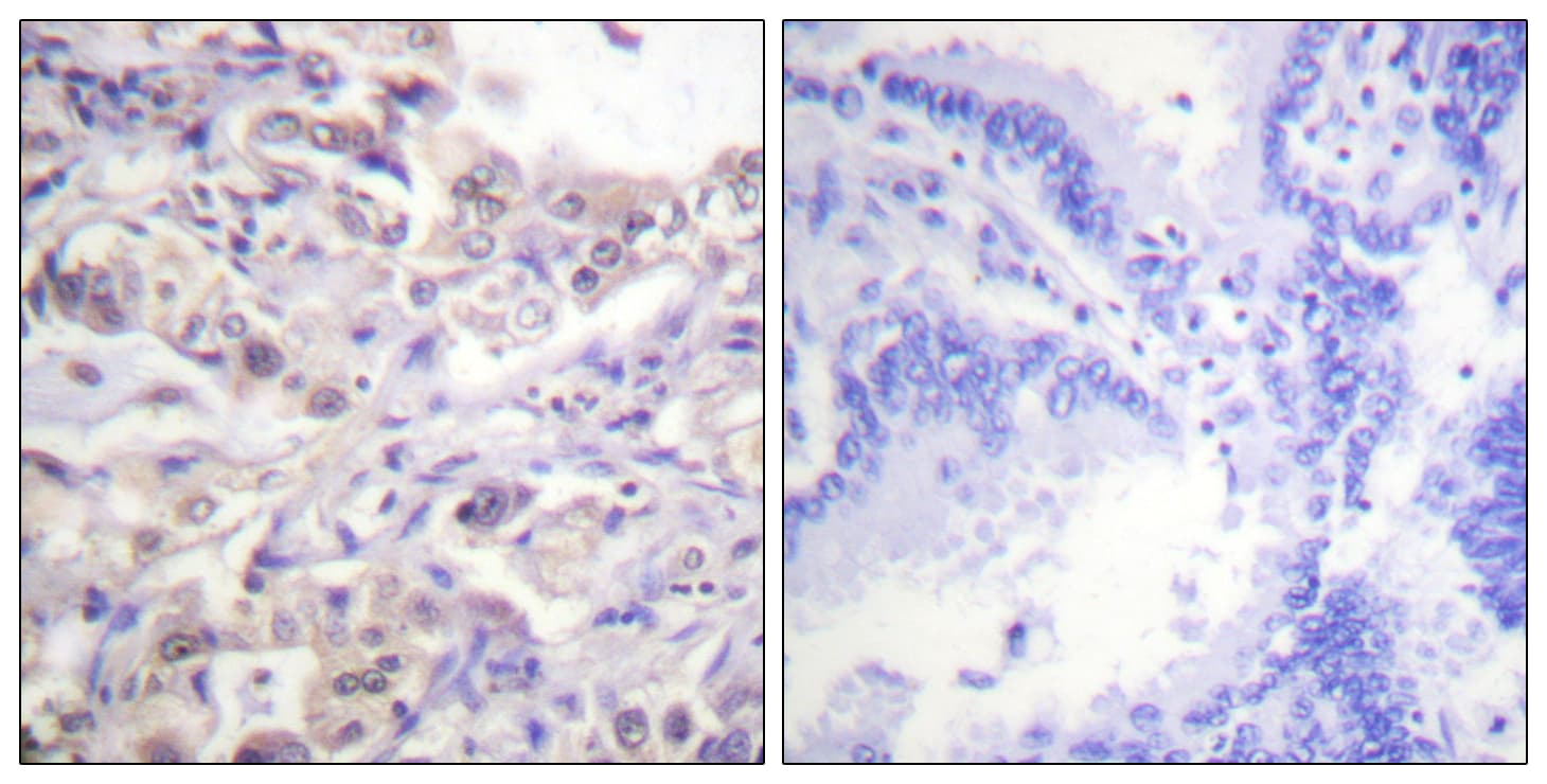 HNRNPD / AUF1 Antibody (phospho-Ser83)