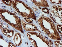 PSMB9 Antibody (clone OTI2B6)