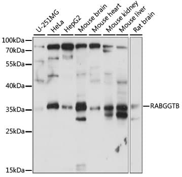 Polyclonal Rabbit anti-Human RABGGTB Antibody (WB)