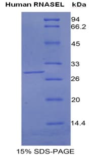 Human RNASEL / RNase L Protein (Recombinant His)