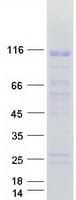 Human ZNF606 Protein (Recombinant Myc-DDK (Flag))