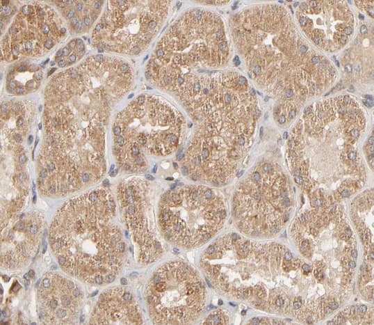 ZAP70 Antibody (phospho-Tyr493)