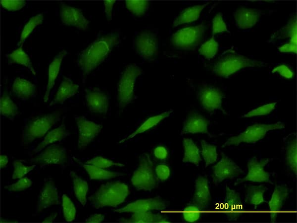 RAB21 Antibody (clone 1F6)