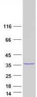 Human METTL6 Protein (Recombinant Myc-DDK (Flag))