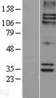 SPAG5 / MAP126 Protein (Over-Expression Lysate Myc-DDK (Flag))