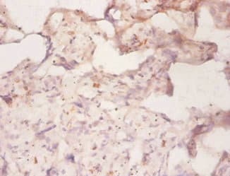 ABCB1 / MDR1 / P Glycoprotein Antibody