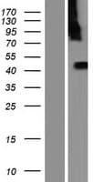 KIAA1984 / PARF Protein (Over-Expression Lysate Myc-DDK (Flag))