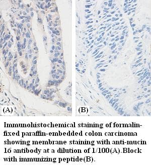 Polyclonal Rabbit anti-Human MUC16 / CA125 Antibody (IHC)