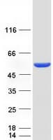 Human PGD Protein (Recombinant Myc-DDK (Flag))
