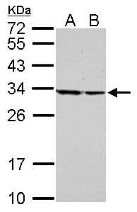Polyclonal Rabbit anti-Human SET / TAF-I Antibody (aa1-45, IHC, WB)