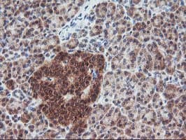 FGF21 Antibody (clone OTI2F10)