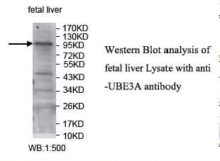 IHC-plus™ E6AP / UBE3A Antibody (aa342-585)
