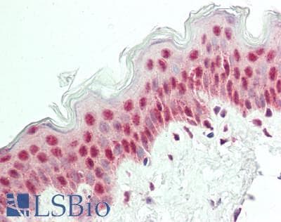 Polyclonal Rabbit anti-Human POU2F3 / PLA-1 Antibody (N-Terminus, IHC, WB)