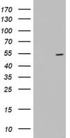 KRT24 / Keratin 24 Antibody (aa139-397, clone OTI2F8)
