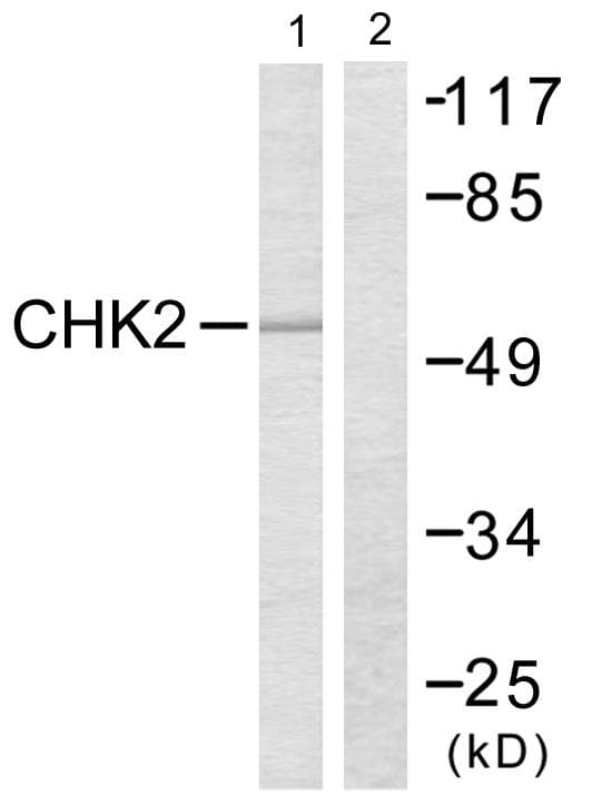 CHEK2 / CHK2 Antibody (p383)