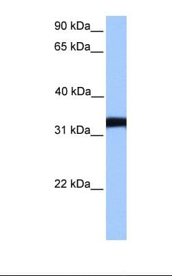LDHC / Lactate Dehydrogenase C Antibody (aa91-140)