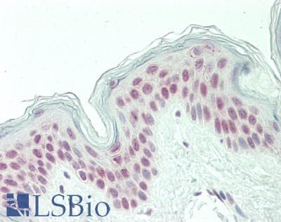 PQBP1 Antibody (aa72-121)