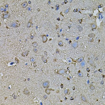 FDX1 / ADX Antibody