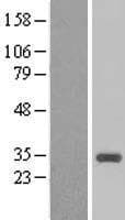 CCNB1IP1 Protein (Over-Expression Lysate Myc-DDK (Flag))
