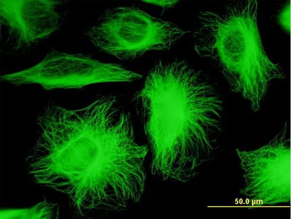 IHC-plus™ TUBB2A / Tubulin Beta 2A Antibody (clone 4C8)