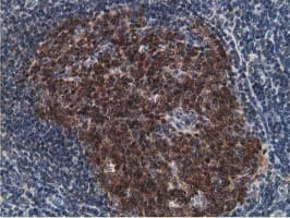 DCK / Deoxycytidine kinase Antibody (clone OTI3F5)