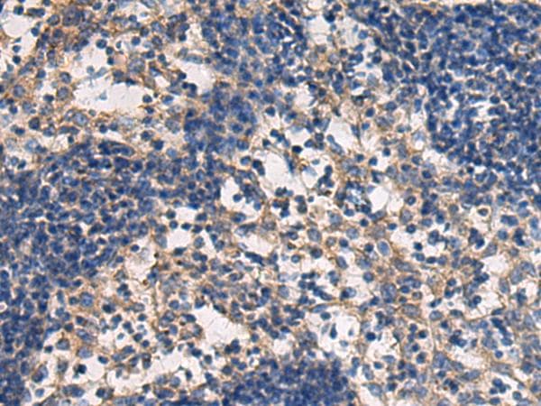 DMRTA2 Antibody