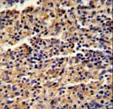ALKBH8 Antibody (aa494-523)