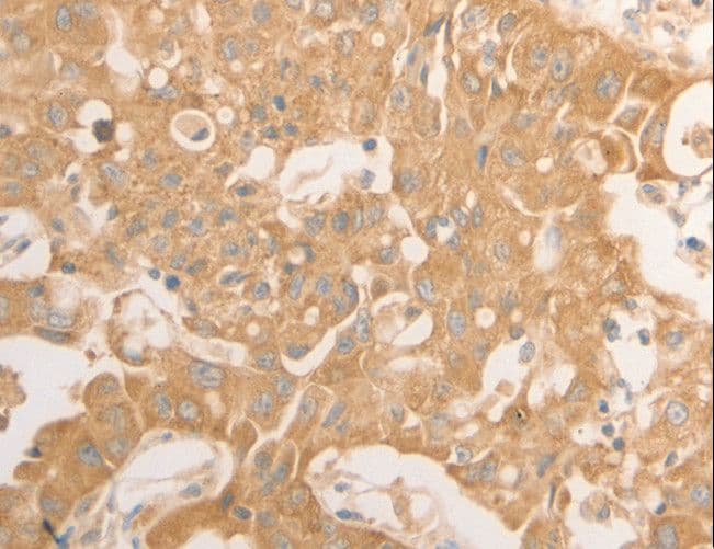 Polyclonal Rabbit anti-Human NAP1L1 Antibody (IHC, WB)