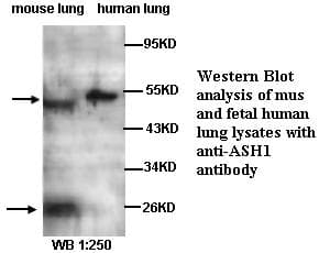 ASCL1 / MASH1 Antibody