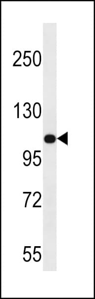 Polyclonal Rabbit anti-Human MYO3B Antibody (aa1086-1116, IHC, WB)