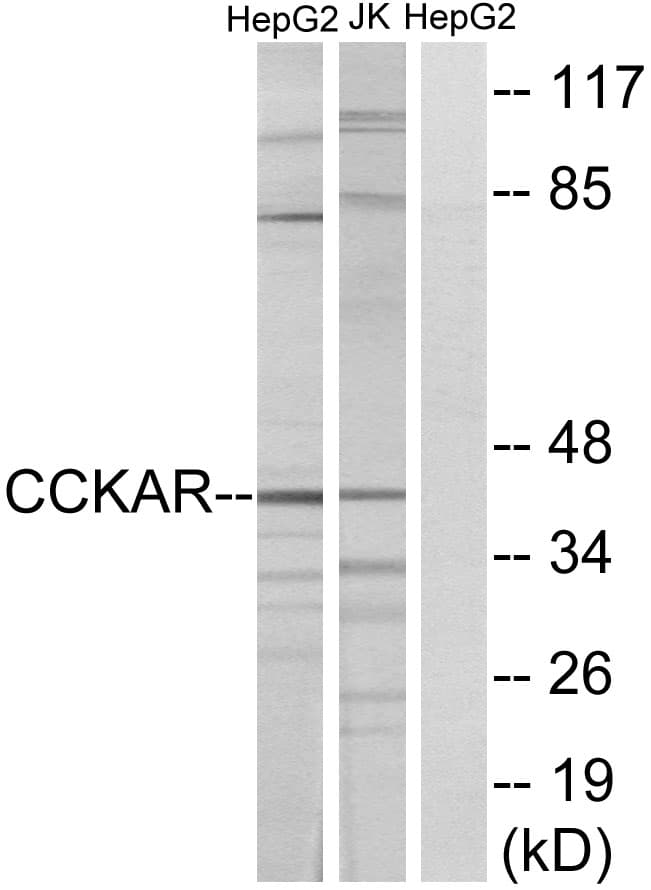 CCKAR / CCK1R Antibody (aa215-264)