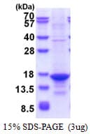 Human TNFSF13 / APRIL Protein (Recombinant)