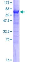 Human Selenium Binding Protein 1 (Recombinant GST)