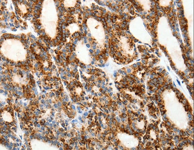 Polyclonal Rabbit anti-Human SSTR1 Antibody (IHC)